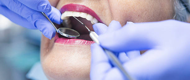 Best After-Hours Emergency Dentist in Mission Nyon, CA